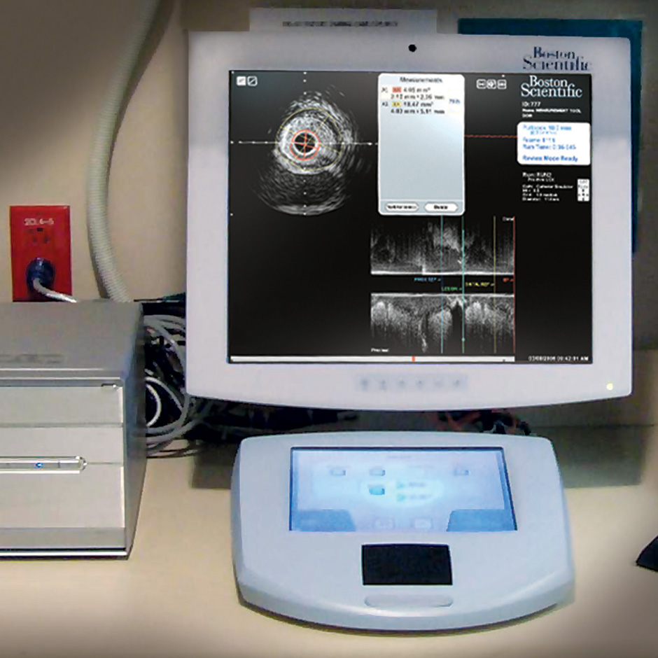 IVUS Monitor