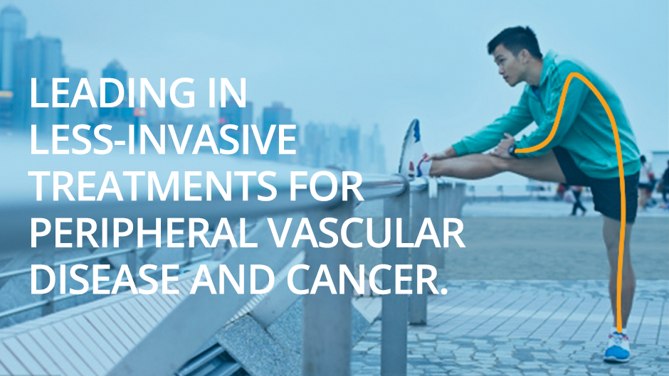 Leading in less-invasive treatments for peripheral vascular disease and cancer.