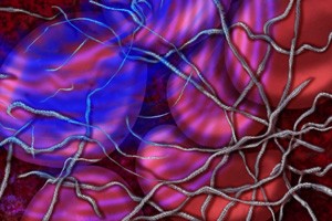 Fibrin with Acoustic Pulse + Lytic