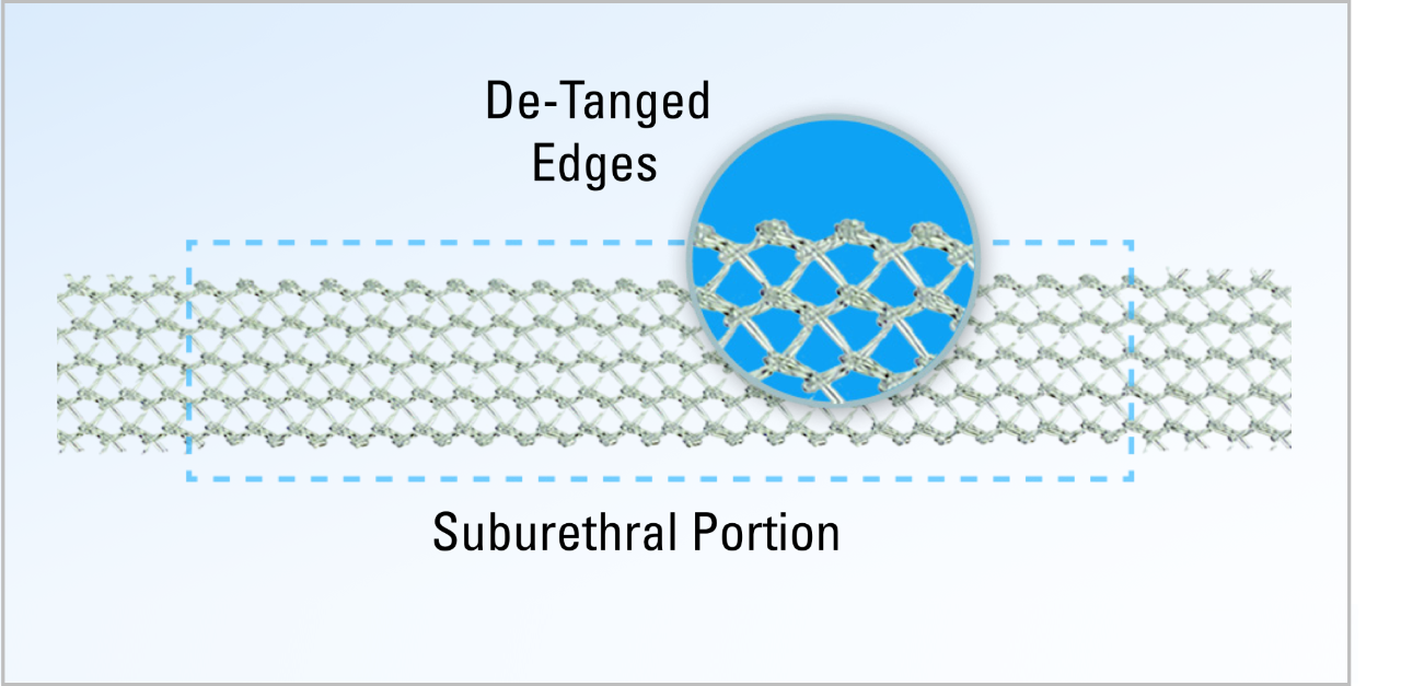 Mesh close up, displaying de-tangled edges on suburethral portion.